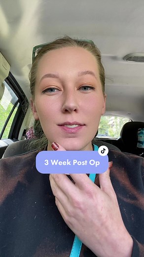 3 Week Denture Update: Realigned & Feeling Confident!