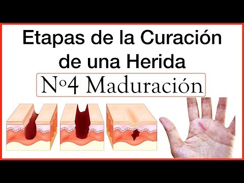 Curación de Heridas, Etapa 4: Maduración