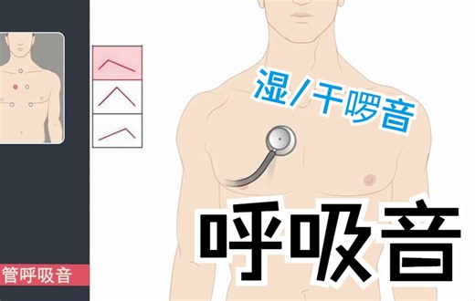 【诊断三分钟】听 呼吸的声音：干啰音湿罗音，哮鸣音水泡音，新冠患者呼吸音