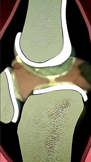 How a Bee Stinger Works: A Detailed Look