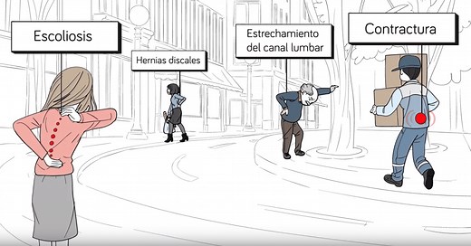 Lumbago y ciática: qué es, síntomas y tratamientos de las enfermedades reumáticas