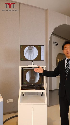 584 reactions · 32 shares | MT-112B Mobile Digital C-Arm — Clear...