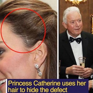 🇬🇧Princess Catherine use her hair to hide the defect | Yellow Royals