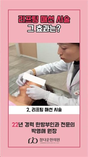 연예인도 받는다는 그 리프팅! #매선리프팅 #리프팅매선 #매선침 #리프팅시술