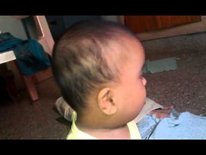 down syndrome kid crying