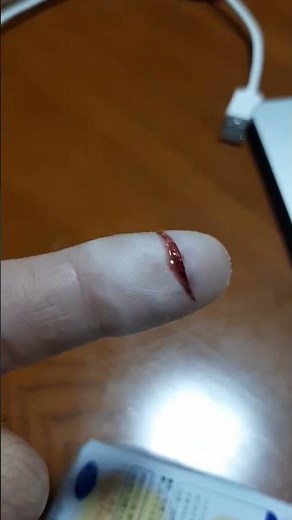 キズパワーパッドだけで深い切り傷治してる(９日経過時)#キズパワーパッド