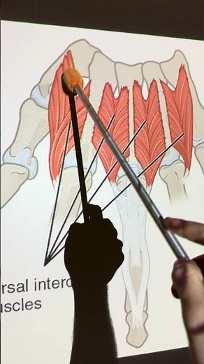 Dorsal Interossei #kinesiology #anatomy #anatomystudy #biomechanics #biology