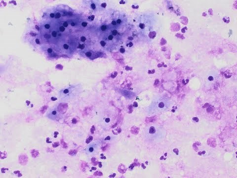 Diagnostic Cytopathology cases