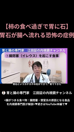【柿で胃石ができる？】食べ過ぎが引き起こす腸閉塞の恐怖と専門医の警告