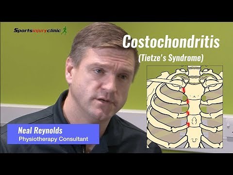 Costochondritis (Tietze's Syndrome) Explained
