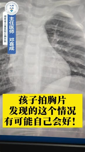 孩子拍胸片发现的这个情况，有可能自己会好。 This condition discovered on a chest X-ray in a child may get better on its own. # Minimally Invasive Surgery # Medical Science # Congenital Heart Disease # Health Knowledge Popularization # Diaphragm Expansion