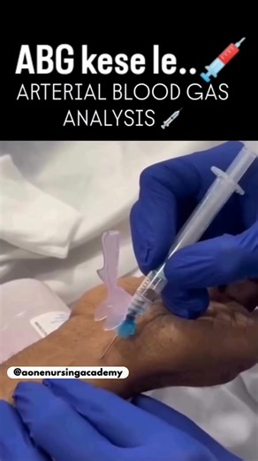 ABG Analysis Procedure Step by Step 💉#tips #shorts #nurse #explain #trick