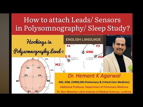Polysomnography Setup: Proper Placement of EEG, EOG, EMG & Respiratory Sensors.@Dr. Hemant K Agarwal