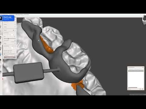 Meshmixer: Fixing Flat Arm on Dental Model (Dental Lab Tutorial)