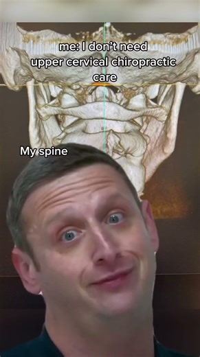 Me: 🤪 My spine: 🫣 If your on the fence about getting your spine images, it’s always a good idea