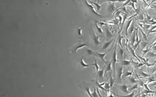 显微镜下成纤维细胞的迁移