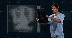 Animation Caucasian Male Doctor X Ray Stock Footage Video (100% Royalty-free) 1095226533 | Shutterstock