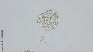 Worm larva Ophelia limacina at trochophora stage under microscope, Opheliidae family, class Polychaeta. Performs a defecatio. White sea