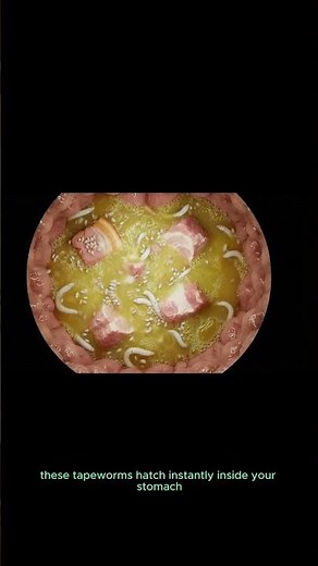 The Shocking Truth About Tapeworms in Pork Meat 🥩🔬