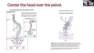 How We Treat Spinal Deformity