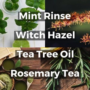 How often do you see commercials for hair products all promising soft, moisturized hair? Too often! Dry hair and scalp is a very common condition, yet somehow, oily scalp and hair gets heavily over looked even though it’s just as common! No one addresses this problem which leaves everyone with oily hair in the dark about their condition. The only solution they ever receive is “go wash your hair” even though you washed your hair that morning. No one ever talks about oily scalp in depth which leav