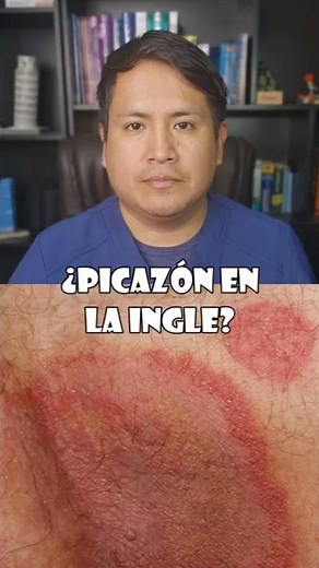 Itchy groin? Could it be a fungus?