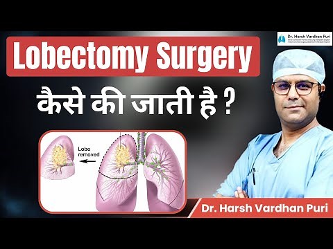 Lobectomy Surgery कैसे की जाती है? | Recovery After Lobectomy | Dr. Harsh Vardhan Puri