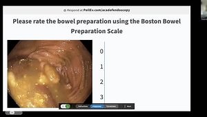 How to Perform a High-Quality Colonoscopy