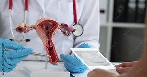 Doctor shows anatomical model of uterus with pathologies of patient