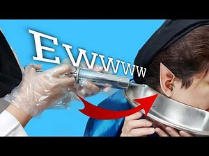 Asian Elf Ear Wax Removal #earwaxremoval #earcleaning #earwax