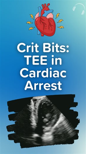 EM:RAP on Instagram: "TEE during cardiac arrest isn’t just a cool tool—it can immediately change management. In this discussion, Haney and Swami explore how TEE helps identify reversible causes like tamponade and PE, allows uninterrupted compressions, and offers unmatched rhythm clarity in peri-arrest patients. They also walk through logistics: • What training and systems are required • When it’s worth deploying during a code • Why is ETT intubation required to use TEE • And why TTE still plays