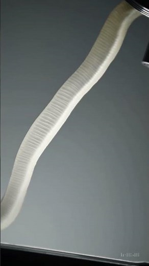 Enterobius vermicularis (Pinworm) under the microscope 🔬A common intestinal parasite.