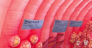 Here's how a giant inflatable colon is spreading awareness of colon cancer