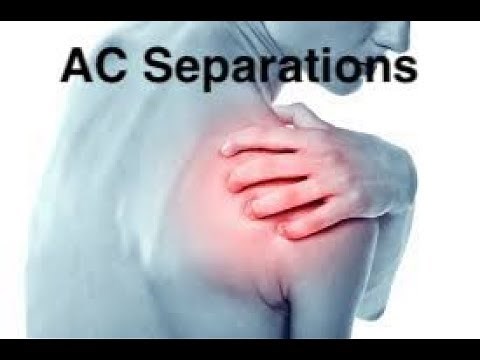 Does an AC Separation or a Separated Shoulder Require Surgery?