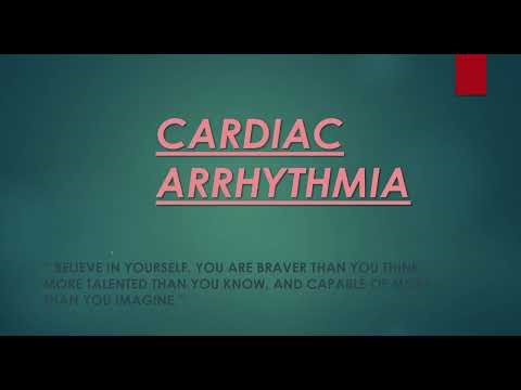 CARDIAC ARRHYTHMIA