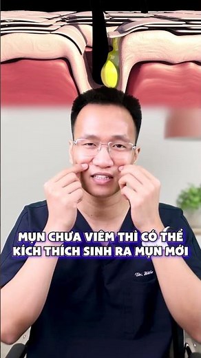 Da đang có mụn mủ mụn viêm ăn đồ cay thế nào? #shorts | Dr Hiếu