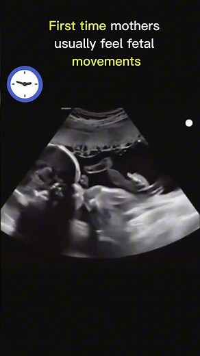 Baby's First Powerful Kicks 💕 in womb 💕 Boy or Gir 🥰 | Ultrasound #pregnancy #ultrasound #baby