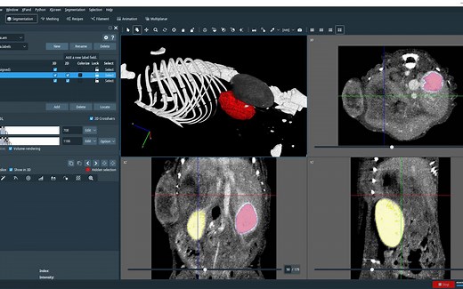 【Avizo/Amira 培训练习】 手工分割工具 Segmentation Editor （小鼠肾脏）