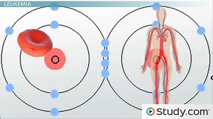 Leukemia: Signs and Potential Treatments