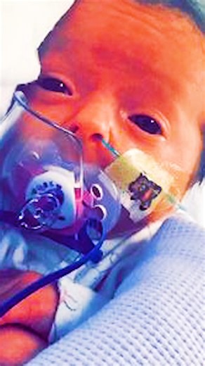 Our daughter is the only 'Benjamin Button' girl in the world 🤍 #fbreels #borndifferent #benjaminbutton #rarecondition #agingdisease | Born Different