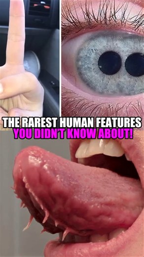THE RAREST HUMAN FEATURES YOU DIDN'T KNOW ABOUT!