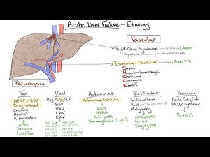 Chalk Talk: Acute Liver Failure