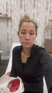 Endometriosis is a condition when endometrial cells do not merge with your uterus during your formation inside your mother, when you are a fetus and tend to stay outside in your abdominal cavity. When you reach the age of menstrual cycle, those cells start to bleed because of hormones, such as estrogen, and now they’re forming chocolate cysts endometriosis has its favorite places, such as the back of the uterus, pouch of Douglas, ovaries, fallopian tubes, and appendix. I have patients who have h