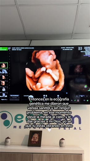 Video de Moca (@mocalainmortal) relacionado con “genetic mutation”