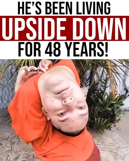 This man's story of resilience will inspire you... See how he overcame challenges and adapted to a life most can't even imagine. | Project Nightfall