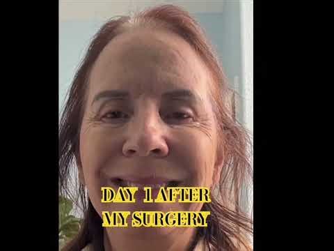 Cataract Surgery Recovery: My First 7 Days After Right Eye Surgery