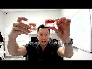 Lost or Losing All Your Teeth? Pros And Cons of All Your Options: Implants, Dentures, All on 4, Snap Ons • Video • MEDtube.net
