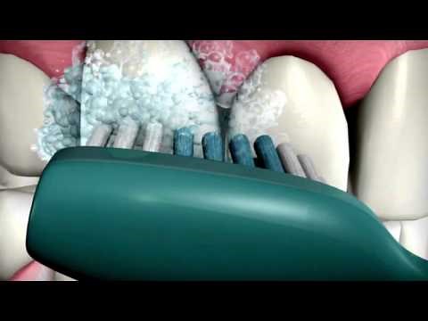 Clinpro™ 5000 Anti Cavity Toothpaste