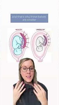 why IUGR babies sometimes do better on the outside than the inside #iugr