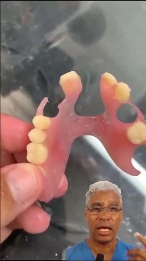 Metal-free discover flexible dentures